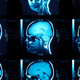 Illustration for article titled Scientists Come Closer to Finding Out What Consciousness Looks Like in the Brain